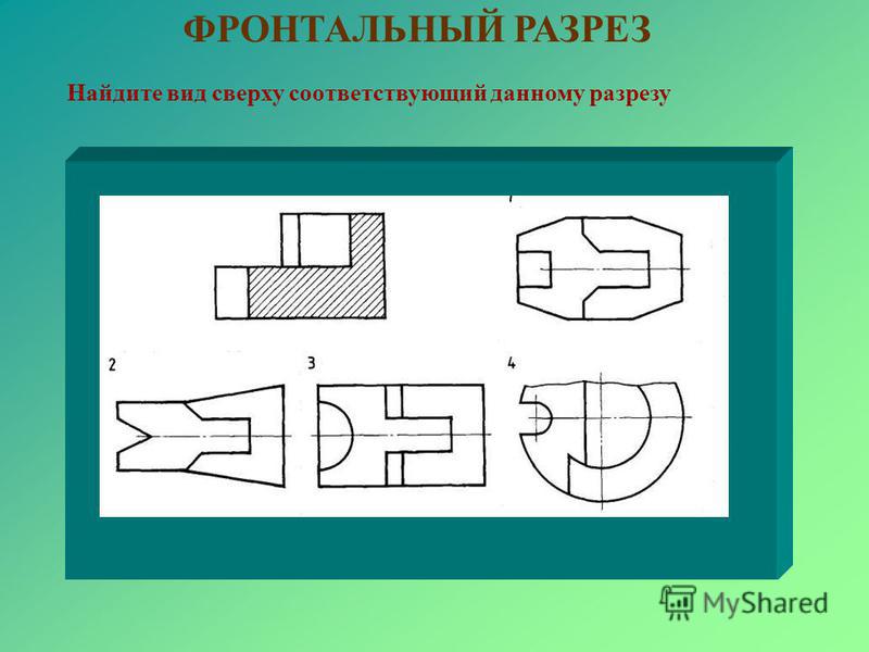 Фронтальный разрез