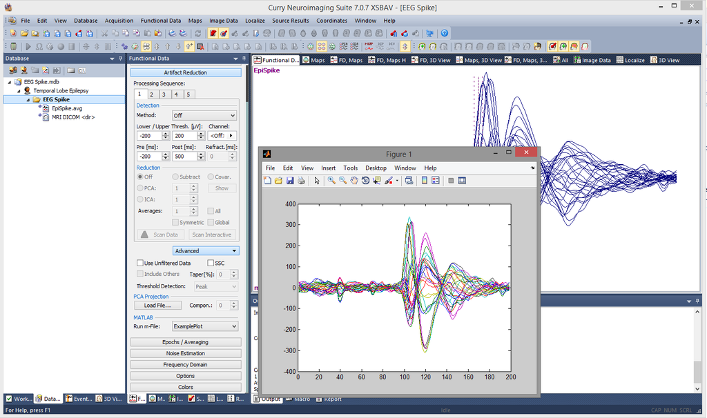 Для чего в реальной жизни используется matlab